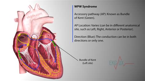 wolff parkinson white syndrome definition